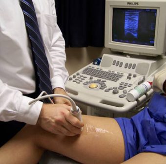 duplex_ultrasound_for_vein duplex_ultrasound_for_vein